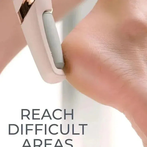 Electric Foot Callus Remover – Pedicure File for Cracked Heels